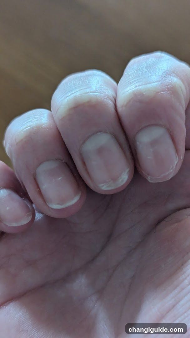 Hand with fingernails