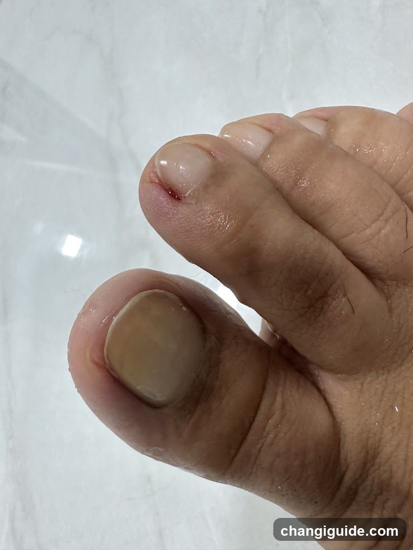 Foot with injured toe