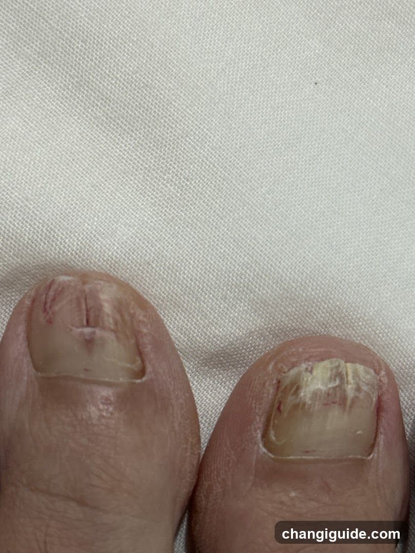 Toes with Nail Issues